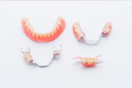 Chrome (Cobalt-Chromium) Dentures in Ipswich