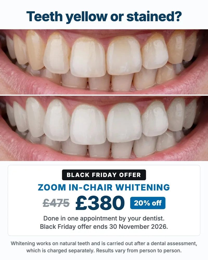 Black Friday offer: 20% off Zoom in-chair whitening, &pound;380 instead of &pound;475, ends 30 November 2026